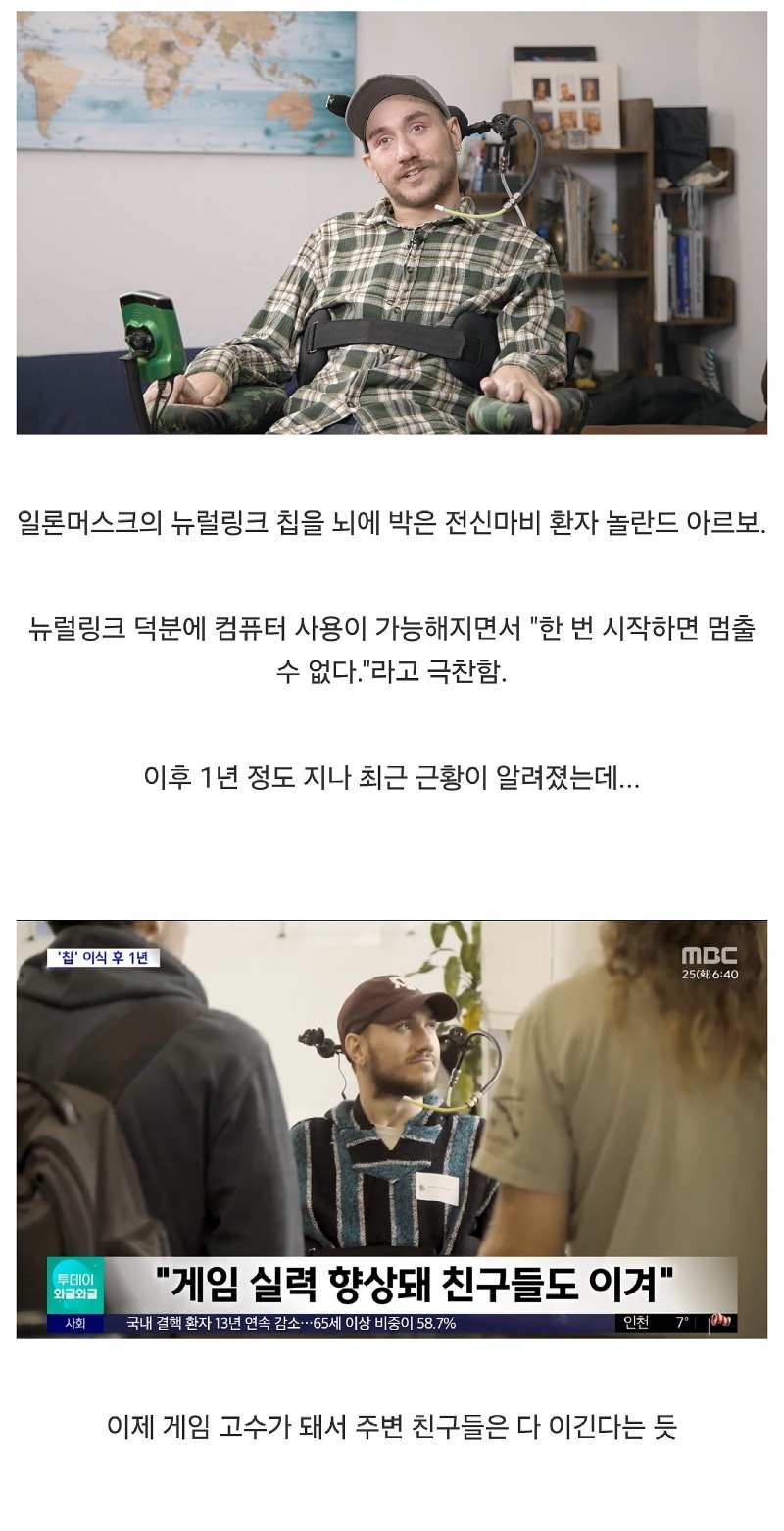 뇌에뉴럴링크칩박은전신마비환자근황.jpg