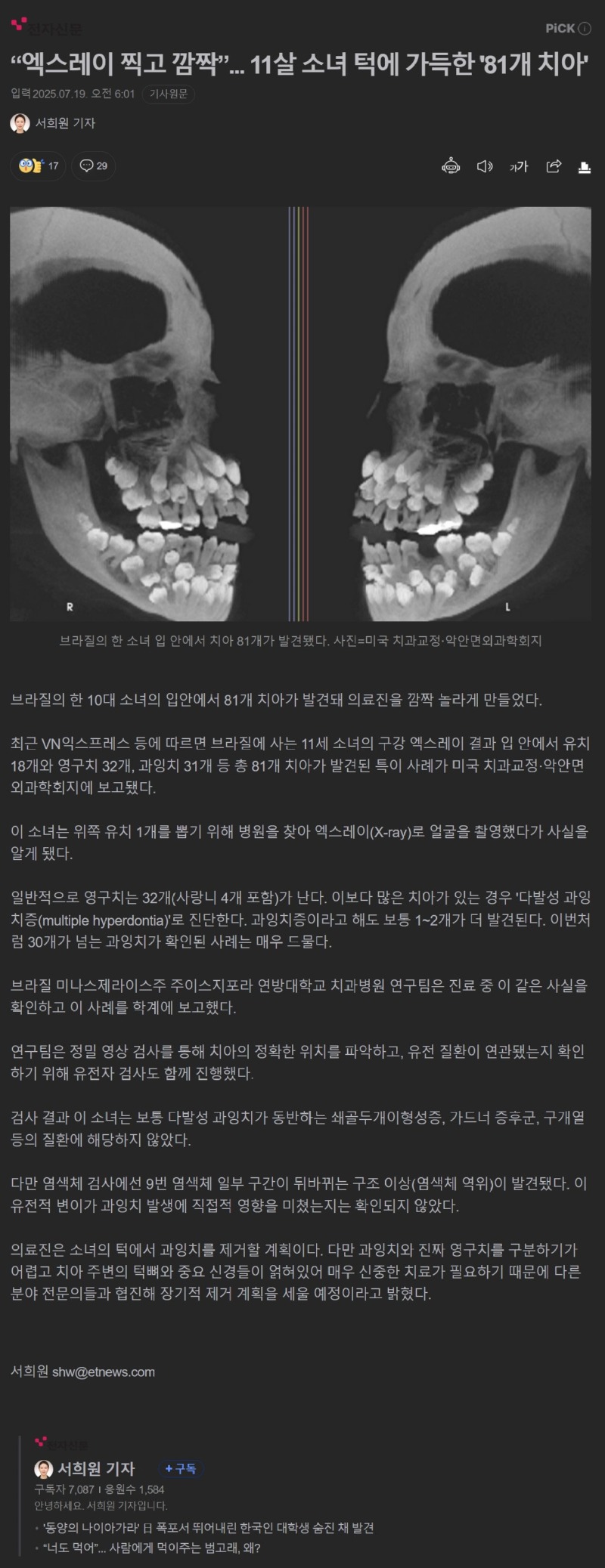 엑스레이찍고깜짝.jpg