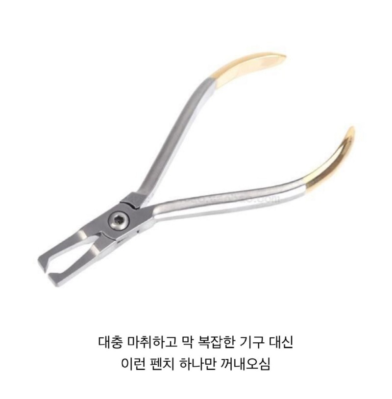 사랑니잘뽑는치과특징3.jpg